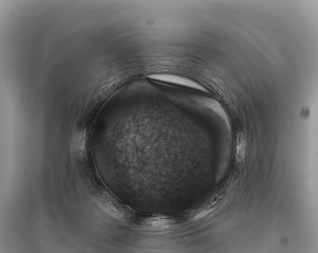 X0000096150219200801251112