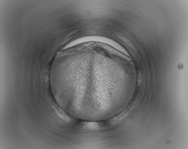 X0000096150409200802011237
