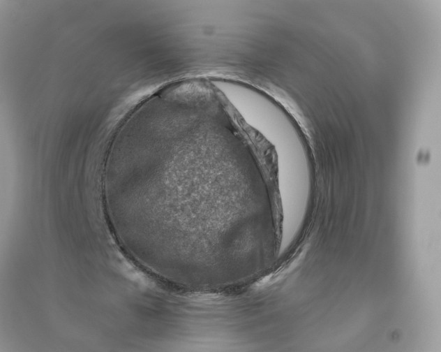 X0000096150577200802011235