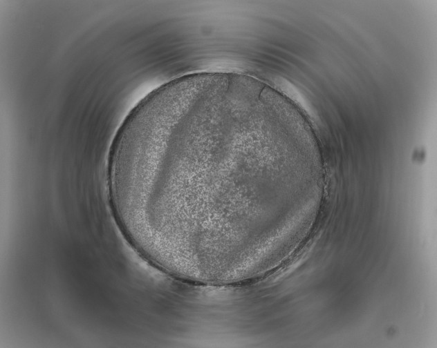 X0000096151087200802011227