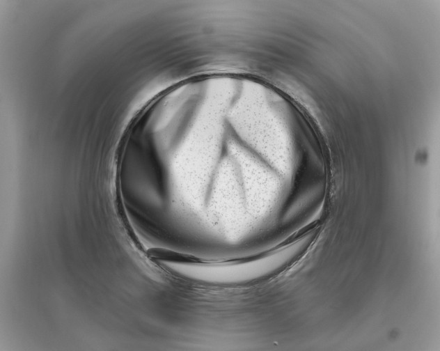 X0000096151179200802011226