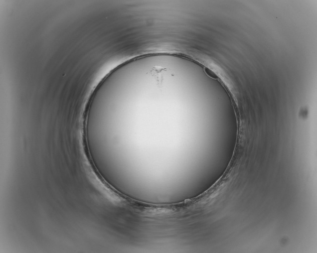 X0000096151187200802011226