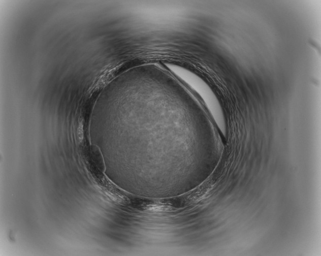 X0000096150504200802081415