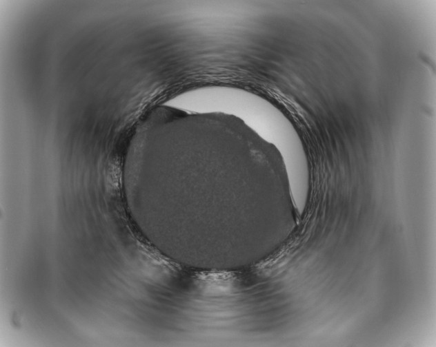 X0000096150517200802081415