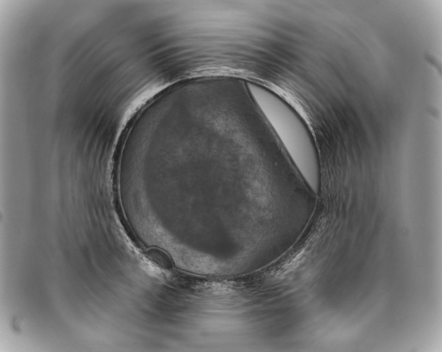 X0000096150995200802081407