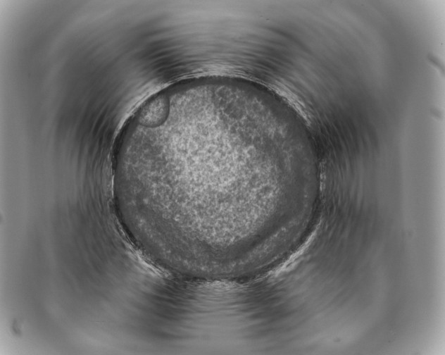 X0000096151117200802081405