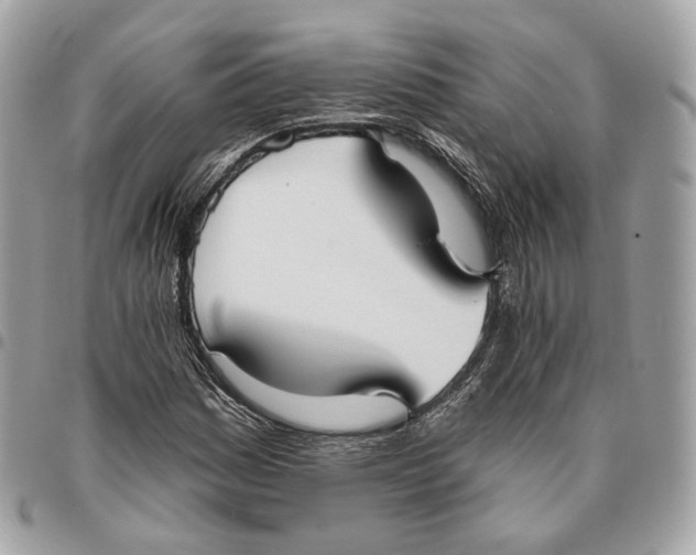 X0000096151161200802081405