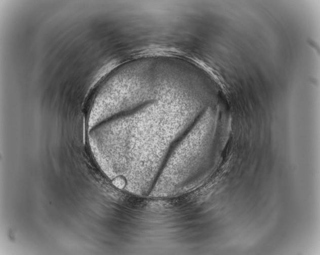 X0000096151219200802081403