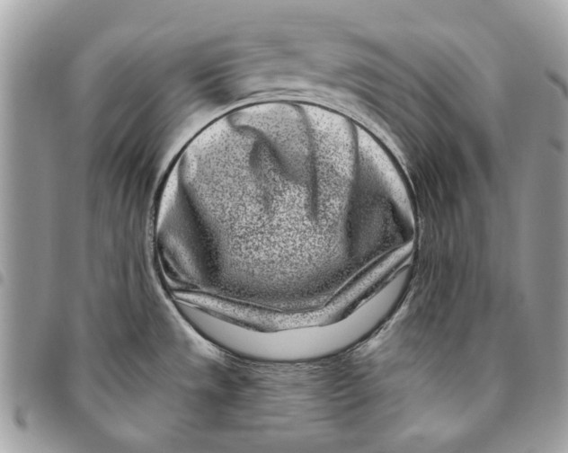 X0000096151533200802081400