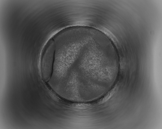 X0000096151077200802151349