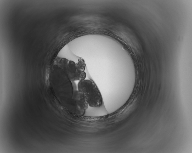 X0000096151396200802151345