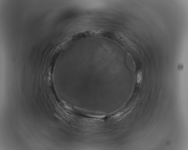 X0000096161011200801181220