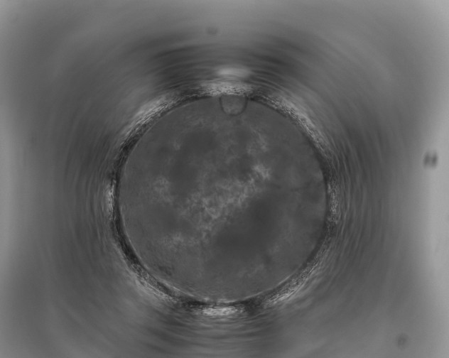 X0000096160357200801251132