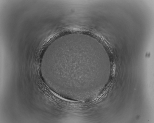 X0000096161157200801251121