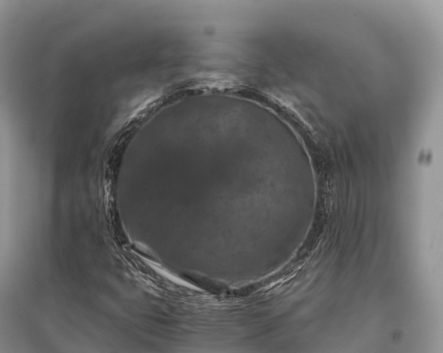 X0000096161399200801251117