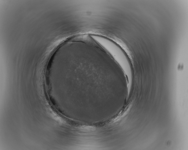 X0000096160577200802011258