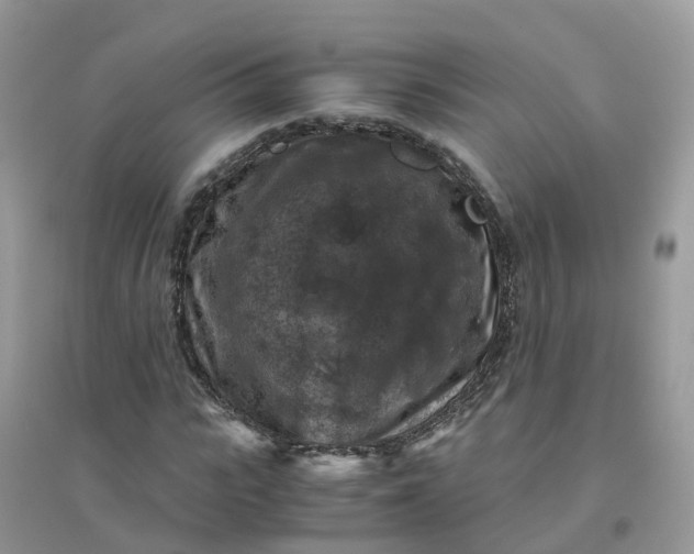 X0000096160919200802011252