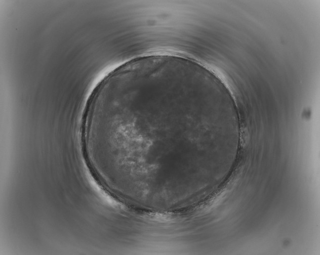 X0000096160995200802011251