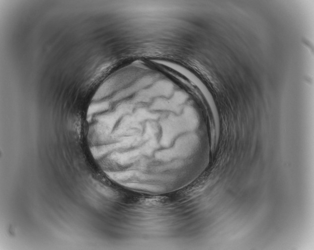 X0000096160072200802081443