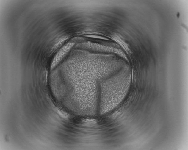 X0000096160157200802081442