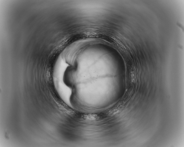 X0000096160618200802081435