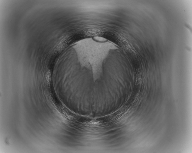 X0000096160647200802081435