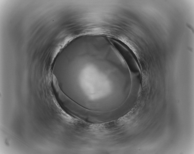 X0000096161477200802081423