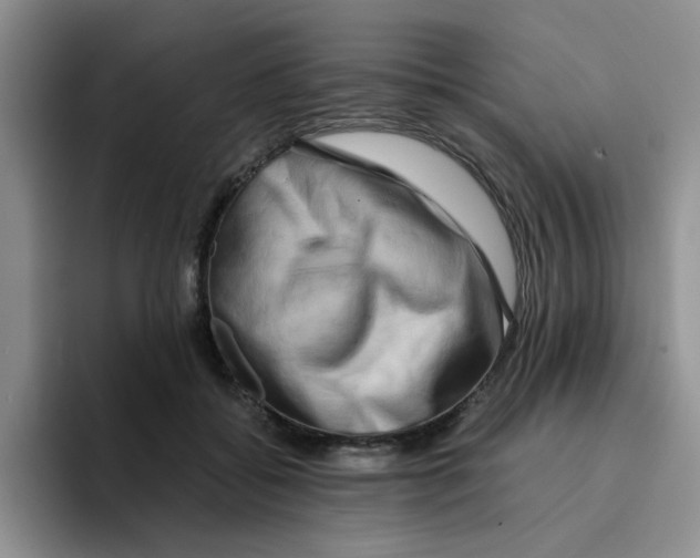 X0000096160556200802151417