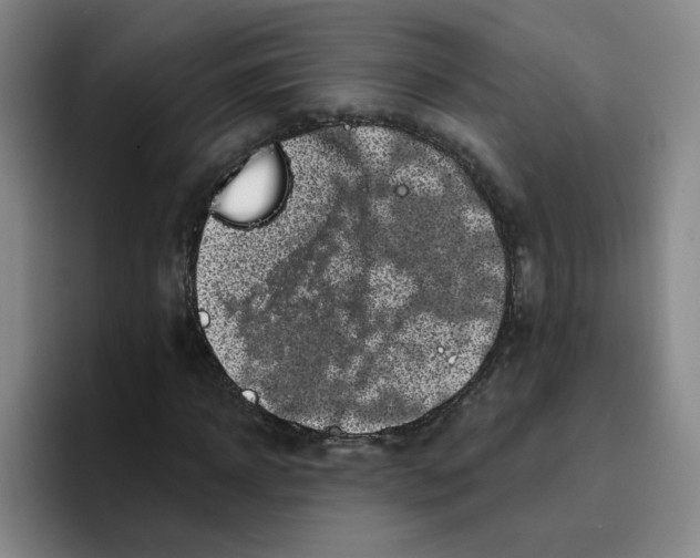 X0000096160918200802151411