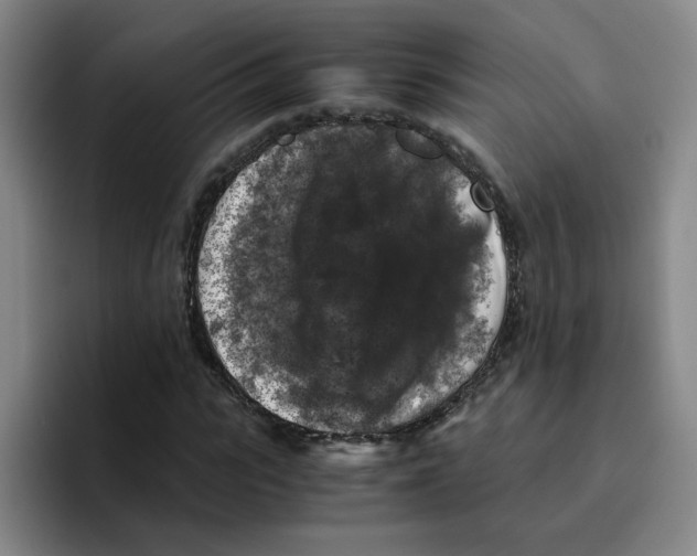 X0000096160919200802151411