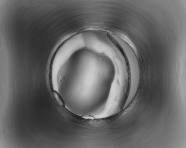 X0000096161146200802151409