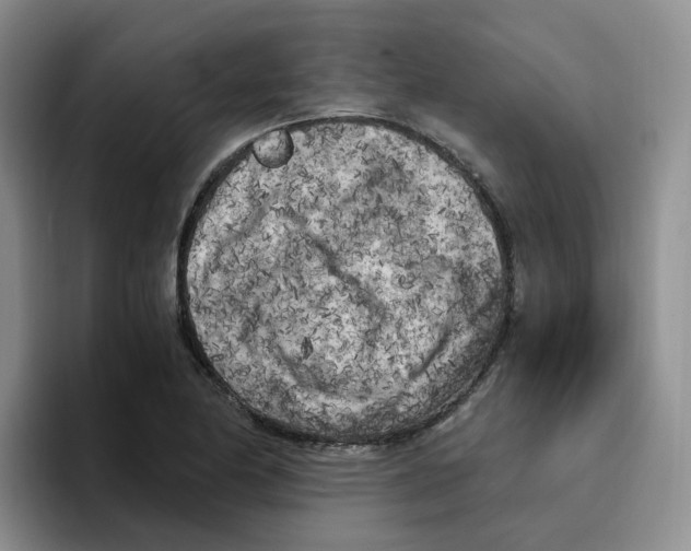 X0000096161174200802151409