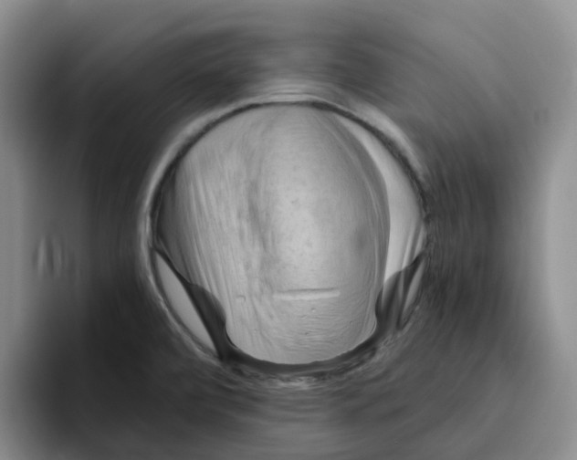 X0000096161472200802151404