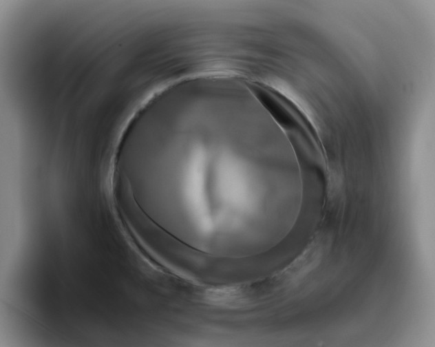 X0000096161477200802151404