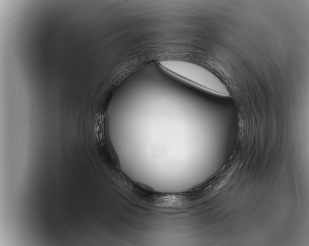 X0000096170237200801180836