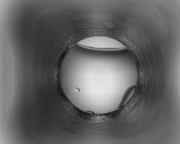 X0000096170379200801180835