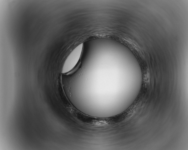 X0000096170572200801180832