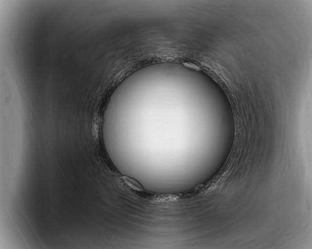 X0000096170576200801180832