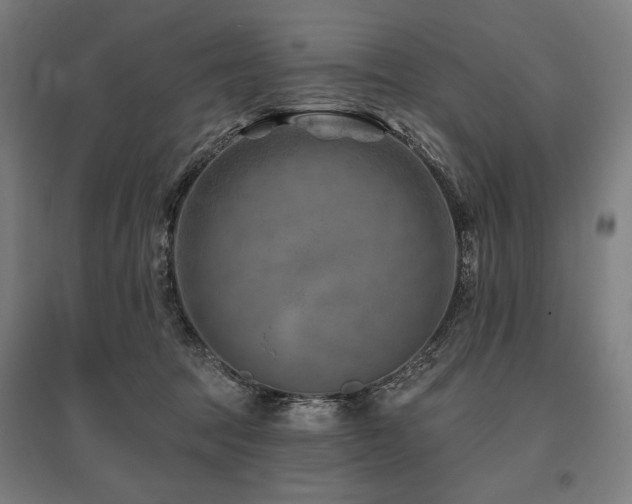 X0000096170369200801181255