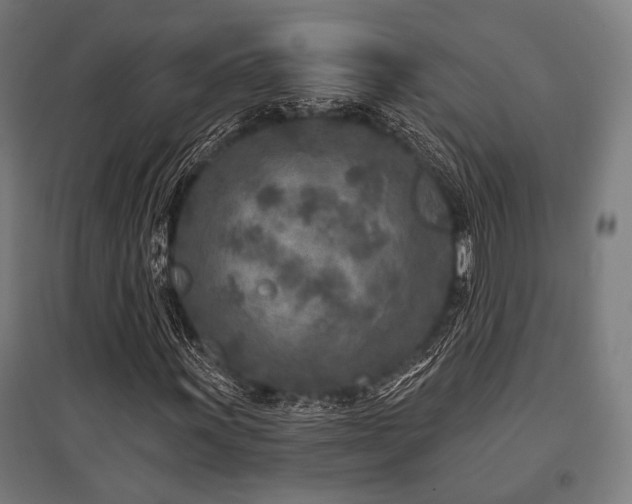 X0000096171011200801181245