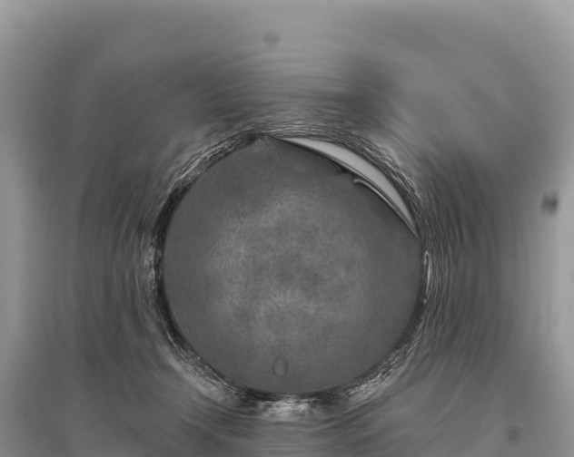 X0000096170366200801251156