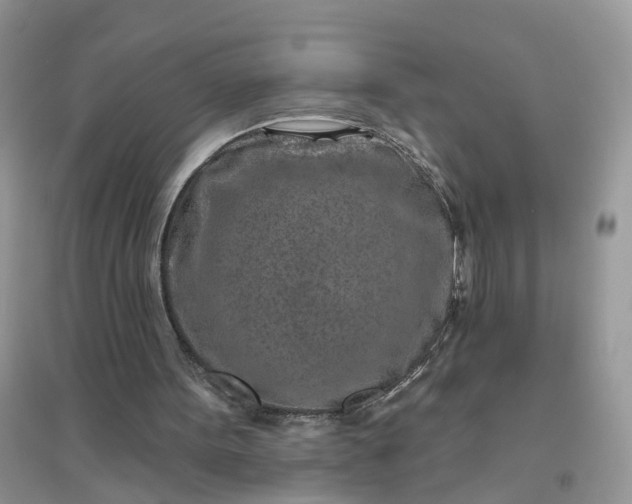 X0000096170099200802011328