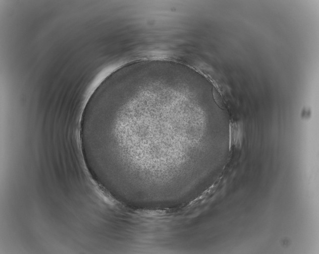 X0000096170147200802011327