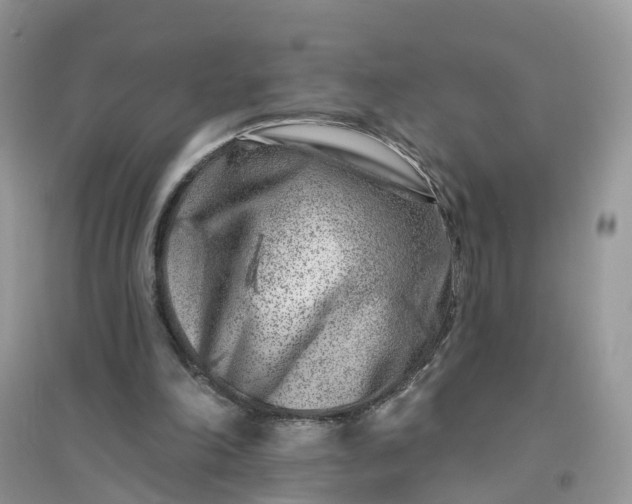 X0000096170198200802011327