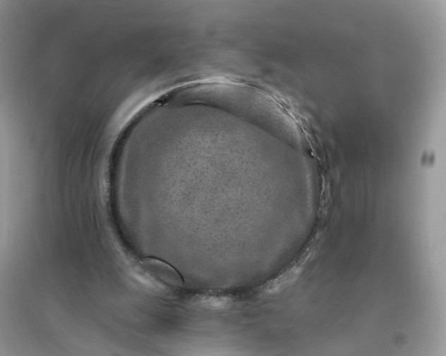 X0000096170247200802011325