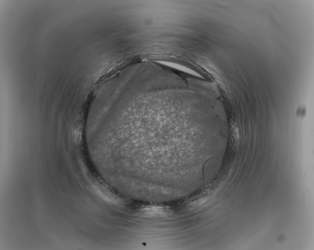 X0000096170499200802011322