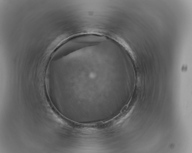 X0000096170577200802011320