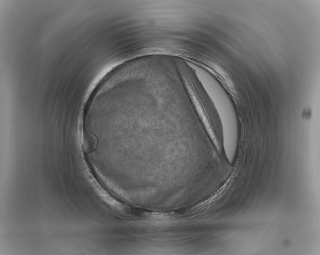 X0000096170796200802011317