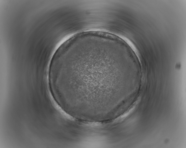 X0000096170957200802011315