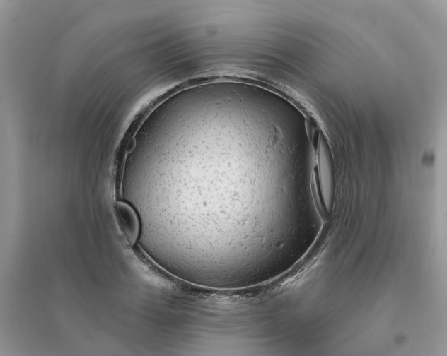 X0000096170987200802011314